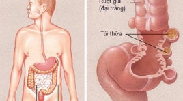 Đặc điểm hình ảnh Xquang cắt lớp vi tính của viêm túi thừa đại tràng