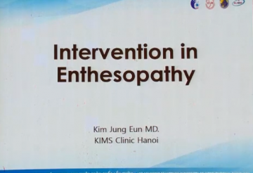 Intervention in Enthesopathy