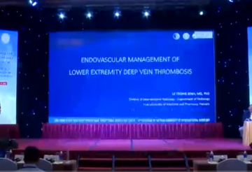 Endovascular treatment for lower extremity deep vein thombosis