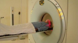 Ứng dụng kỹ thuật PET/CT mô phỏng lập kế hoạch xạ trị ung thư