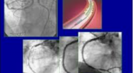 Những tiến bộ trong chẩn đoán hình ảnh bệnh tim – mạch