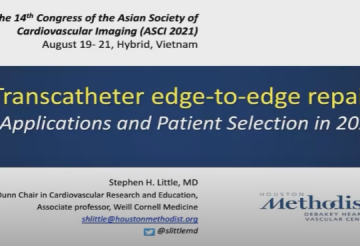Transcatheter edge-to-edge repair: applications and patient selection in 2021